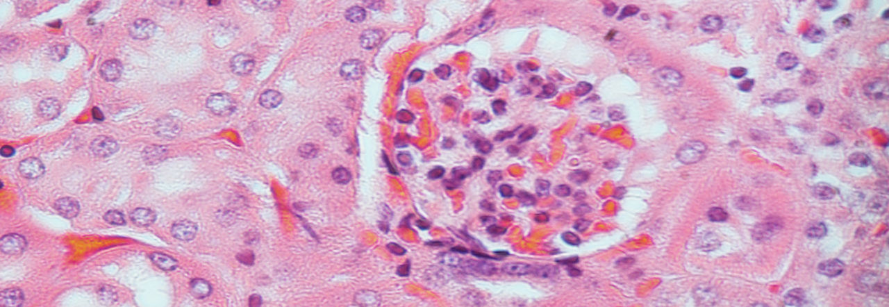 Division of Infectious Diseases and Immunology UMASS Medical School