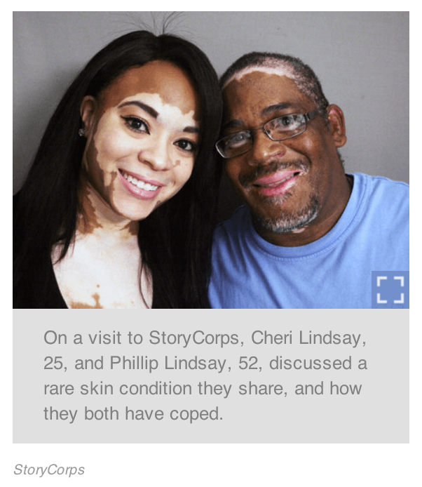 NPR vitiligo story, father and daughter with vitiligo
