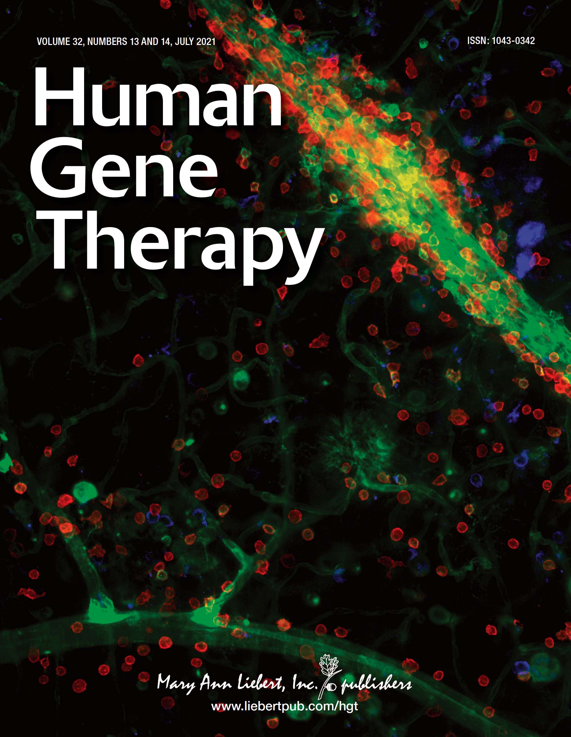 Retinal Vasculitis with Anti-VEGF treatment