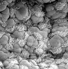 Micrograph of a mouse trachea.