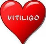 Southeast Michigan Vitiligo Support Group - Detroit 