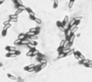 bacteria-micrograph