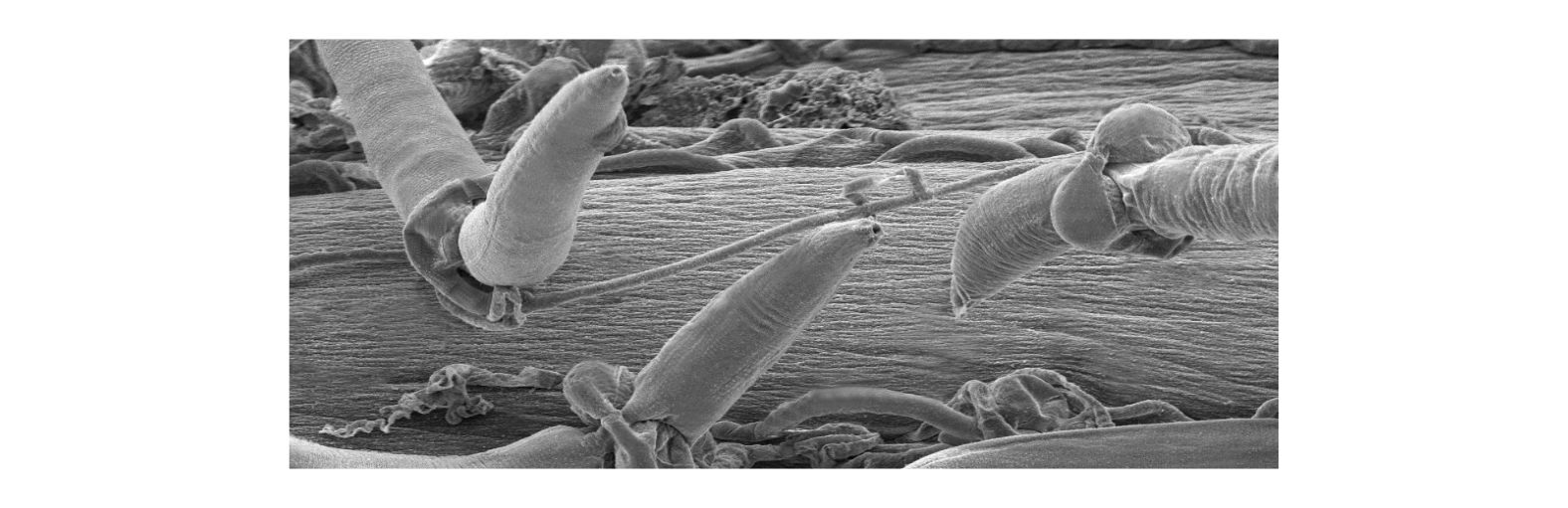 Nematode trapped by fungus