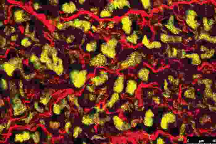 A microscopy image with green dots, red strands and yellow blobs on a black background