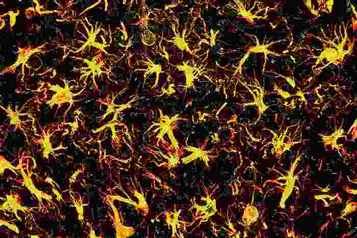 A microscopy image of yellow neurons looking like stars with a red outline, in a black background with green dots 