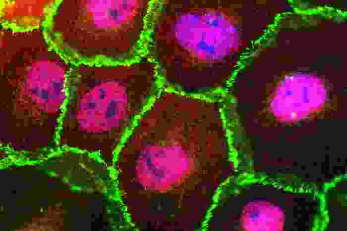 A close up to a group of cells with a green outline, each one has a blue and pink center