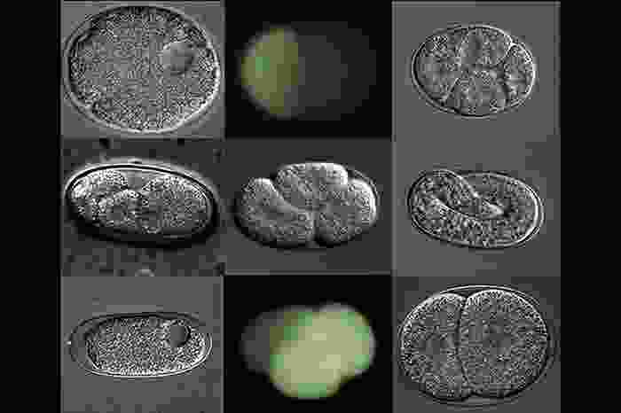 a grid of images in grey and black, and green and black showing the eggs of a worm