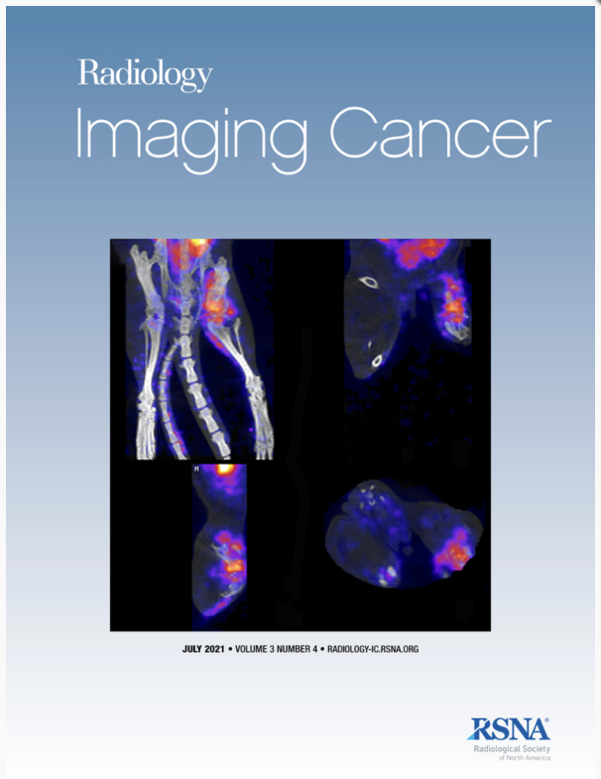 Radiology Imaging Cancer