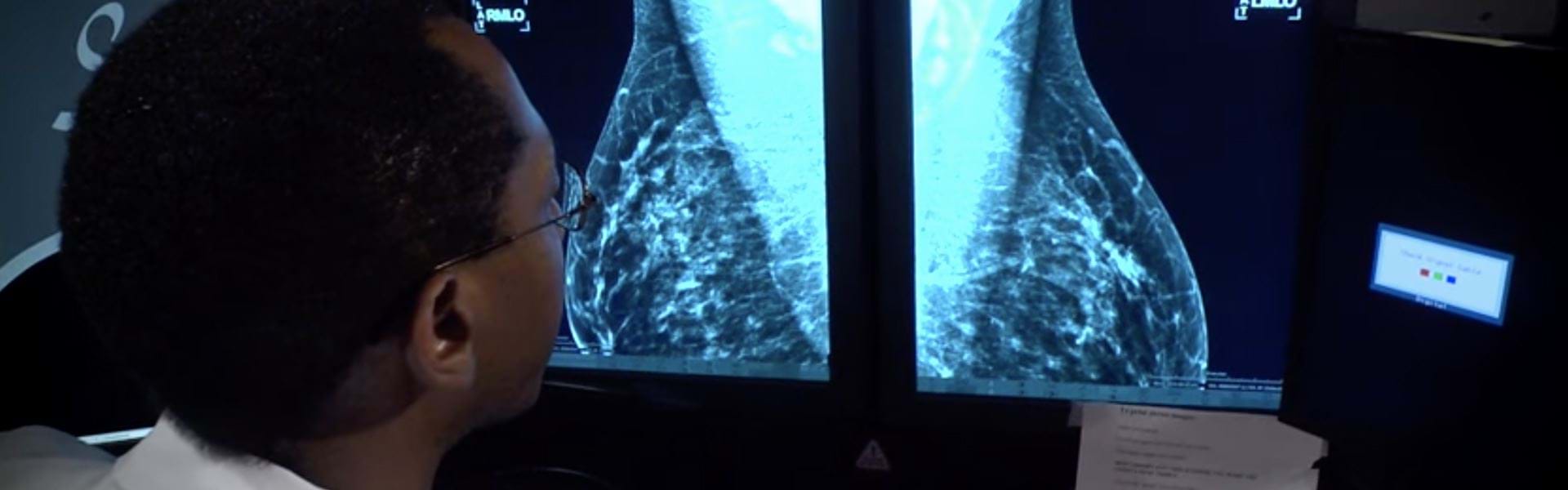 breast-cancer.jpg