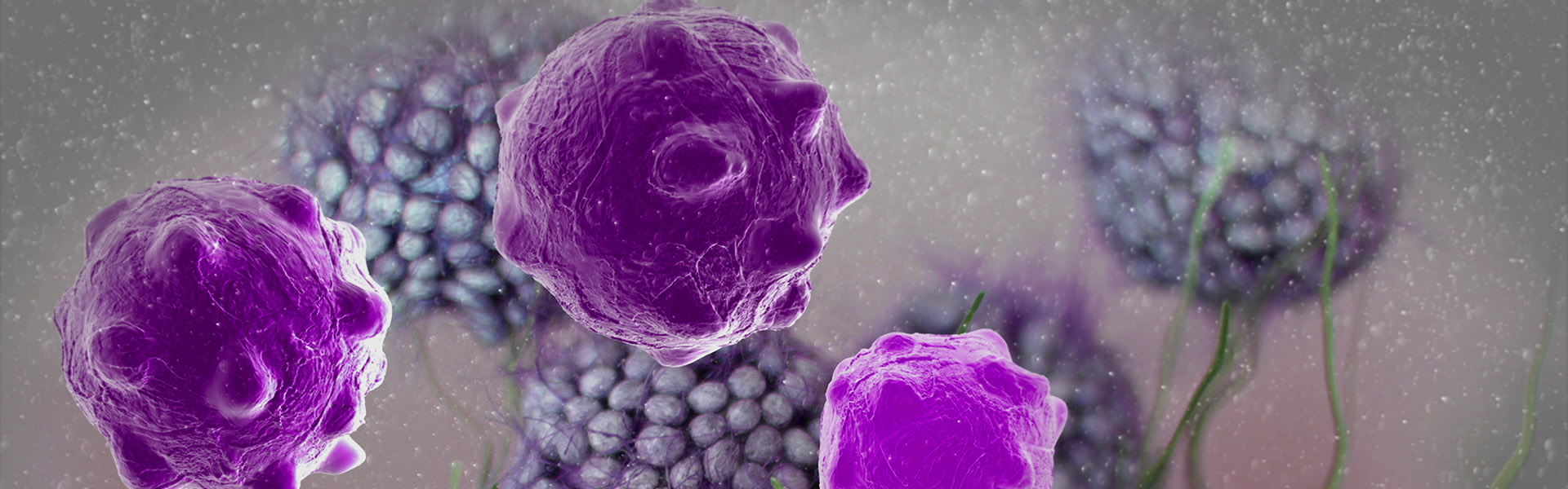 3d cancer cells in body adobe copy.jpg