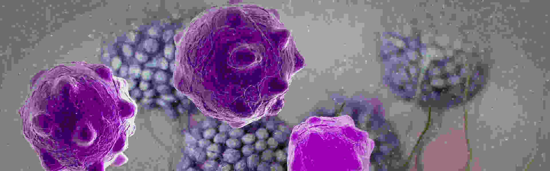 3d cancer cells in body adobe copy.jpg