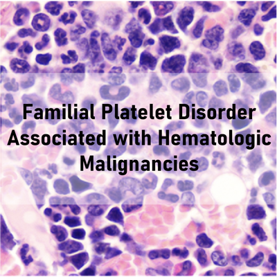 Familial Platelet Disorder Associated with Hematologic Malignancies