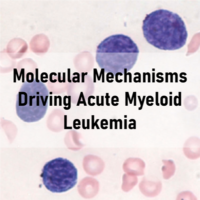 Molecular Mechanisms Driving Acute Myeloid Leukemia