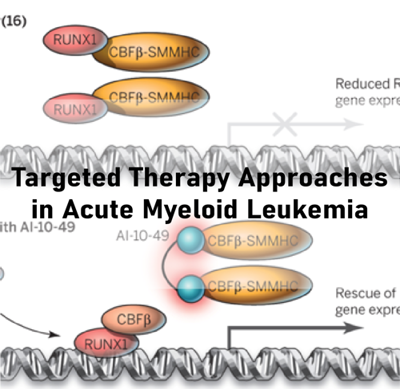 Targeted Therapy Approaches in Acute Myeloid Leukemia