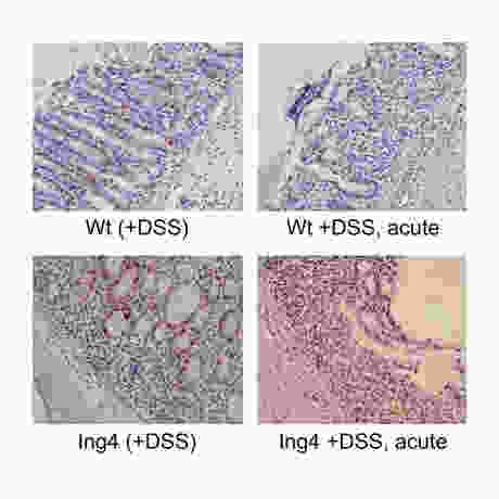 Modelling inflammatory bowel disease in Ing4-null mice.