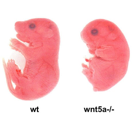 Progress defects in Wnt5a-null mice.