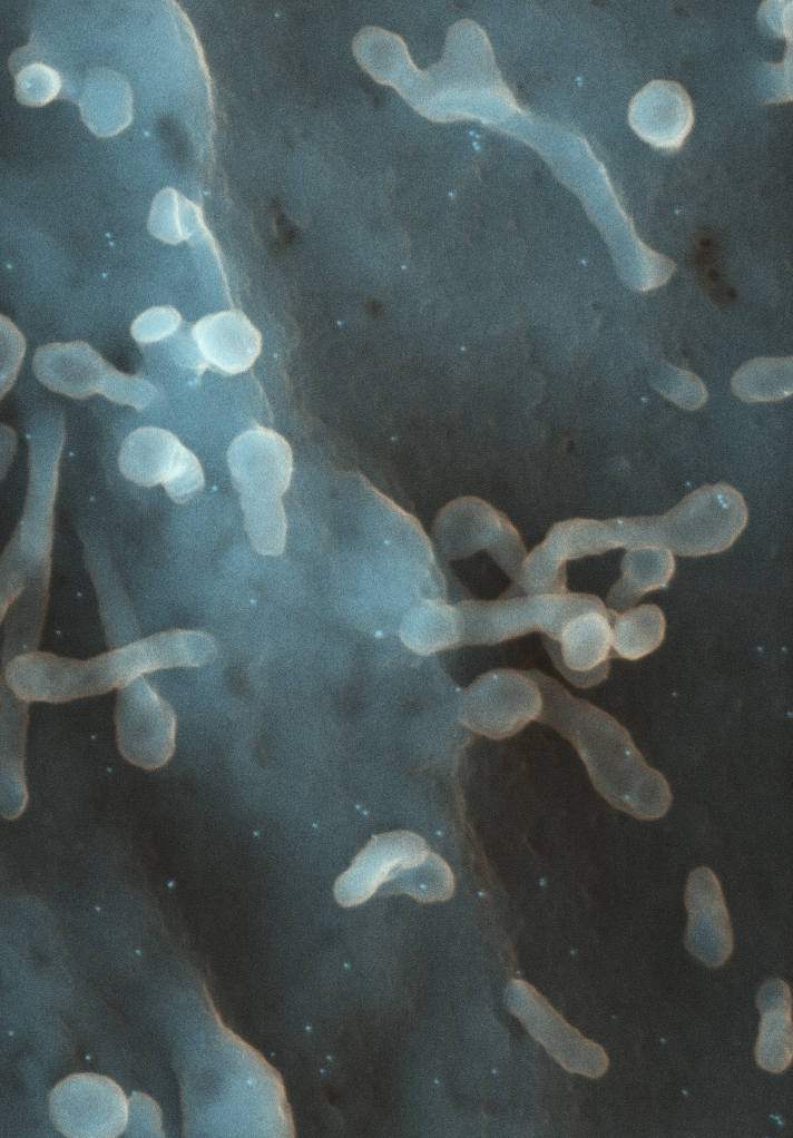 Immuno labeled Spiny dendrite cell-SEM 