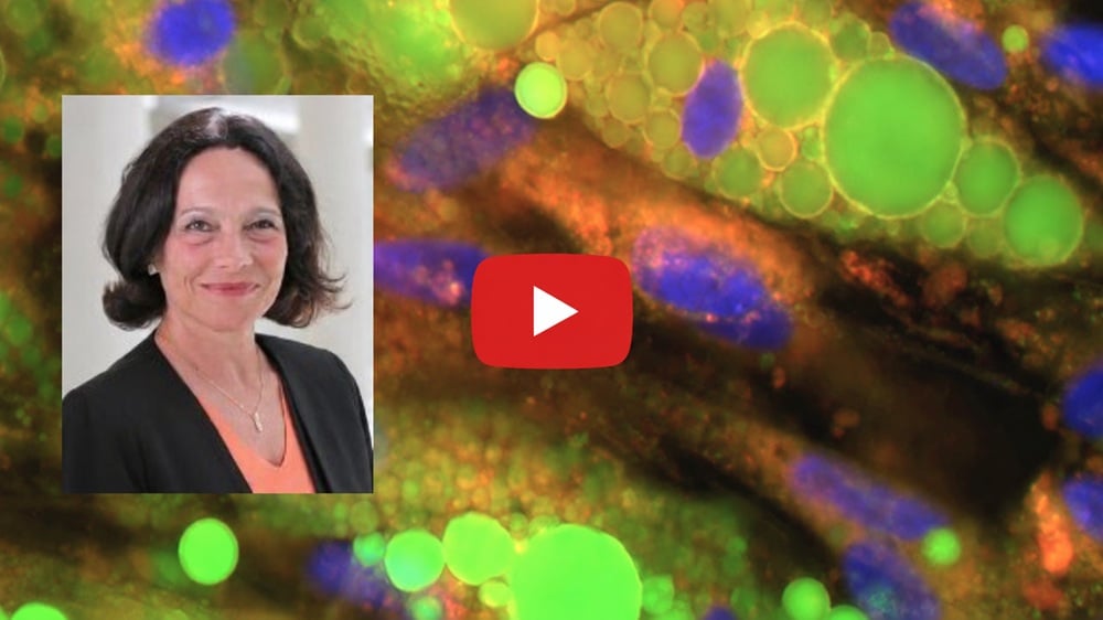  Headshot of Dr. Corvera next to Beige Fat Cells and a YouTube play button