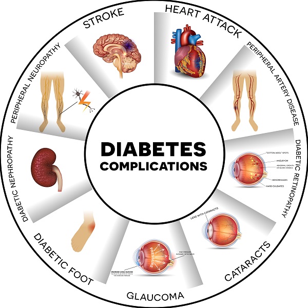 Chronic Complications of Diabetes Mellitus: A Mini Review