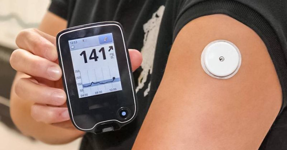 Type  diabetes glucose monitoring