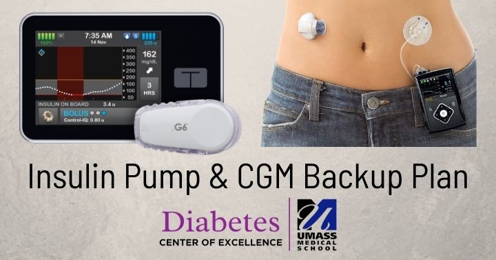 Insulin Pump CGM Backup Plan