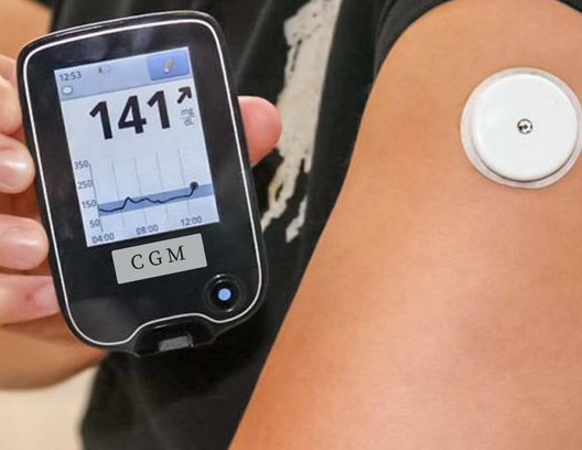 Continuous Glucose Monitor Diabetes