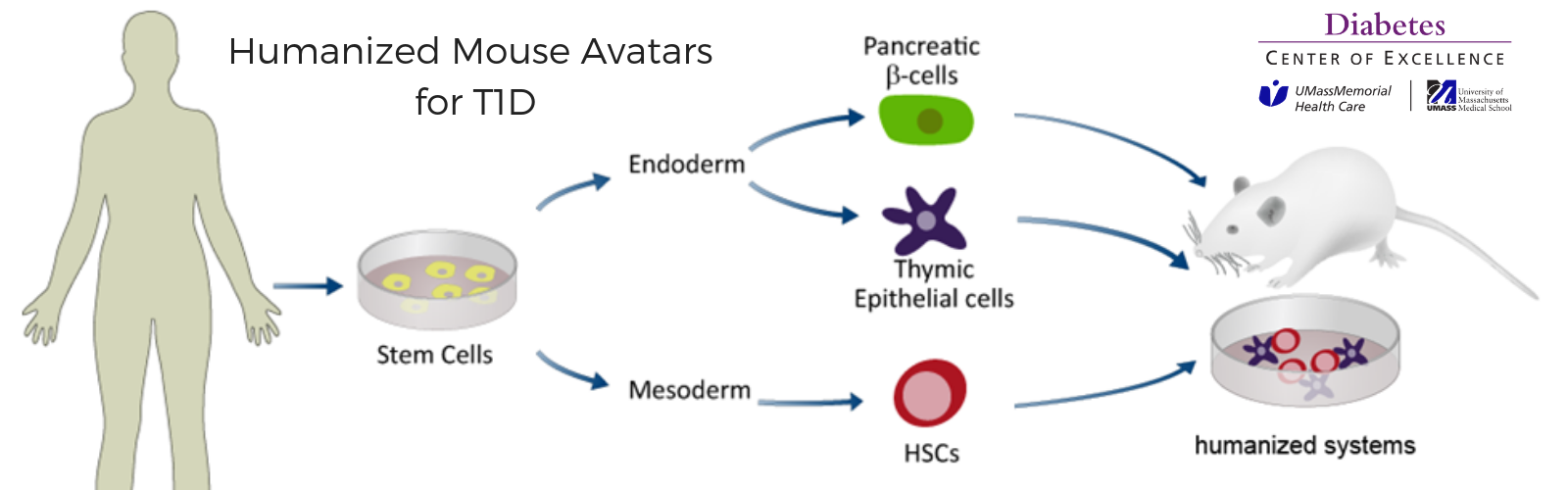 stem cell research on type 1 diabetes