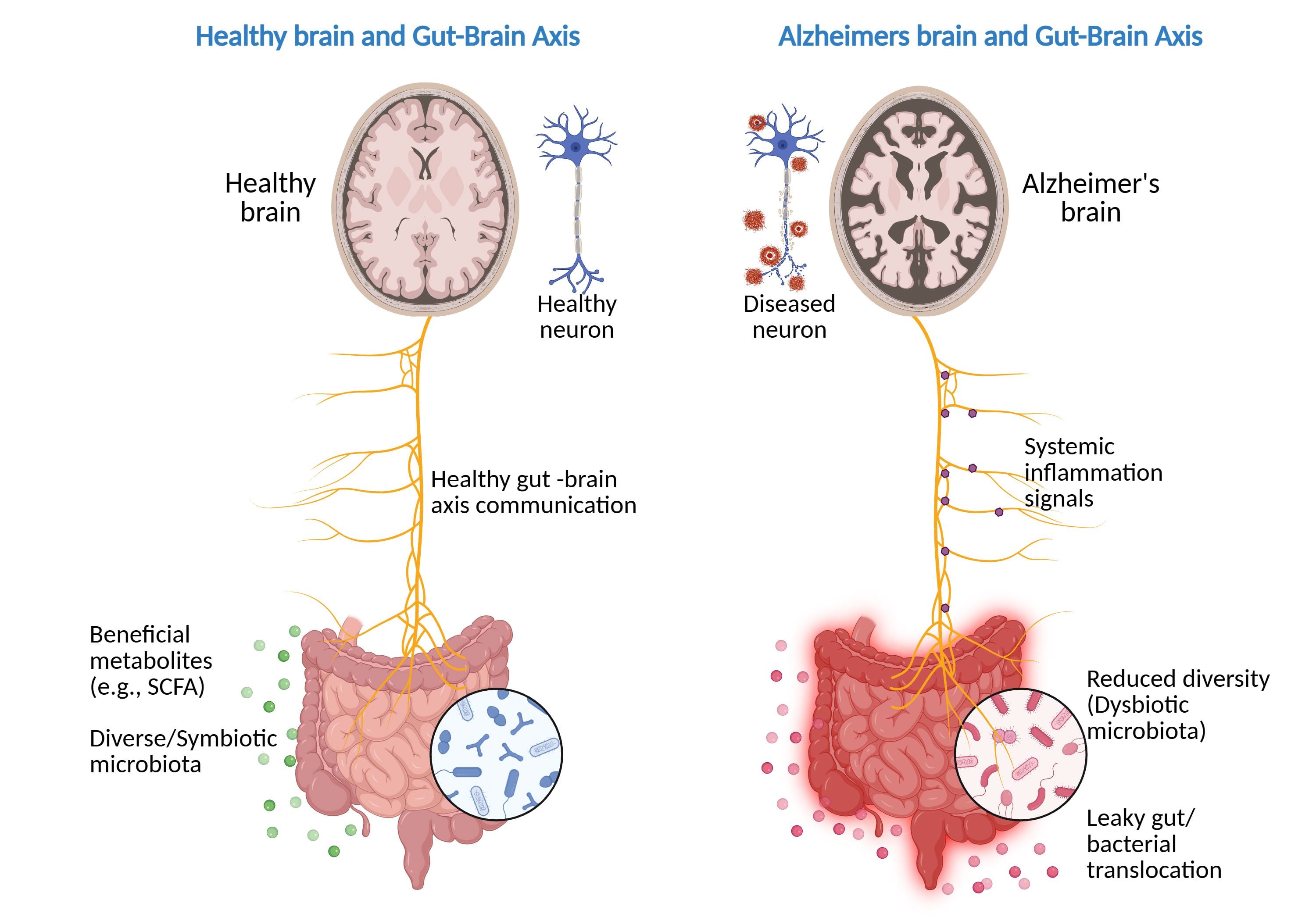 Comparison of Healthy and Alzheimer's Brain and Gut-Brain Axis Function.png