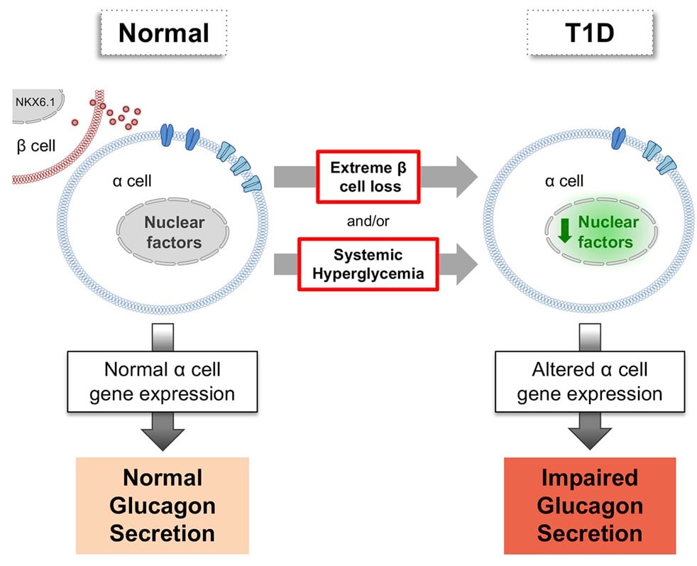 diabetes research type 1