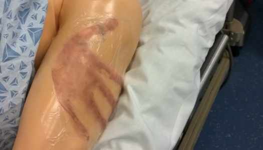 iCELS-SANE-Sexual Assault-Nurse-Examiner-Course