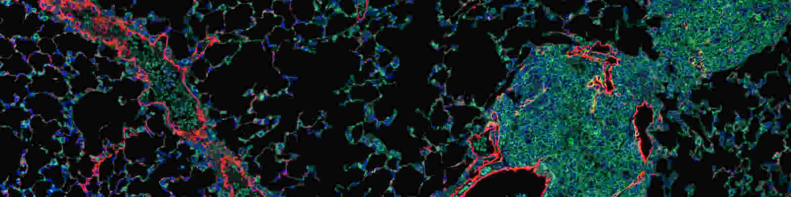 tertiary lymphoid organ in a mouse lung stained with LYVE-1 in red, STING in green, and DAPI for nuclei in blue