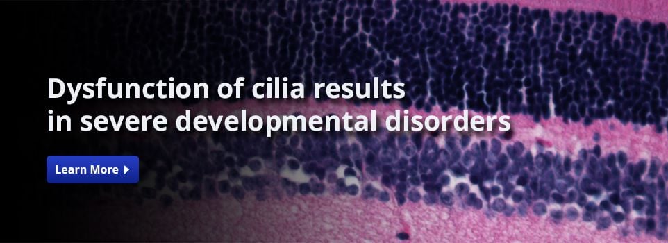 Dysfunction of cilia