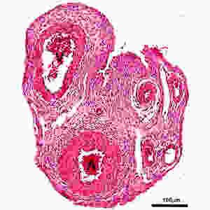  research-umbilical-cord.jpg
