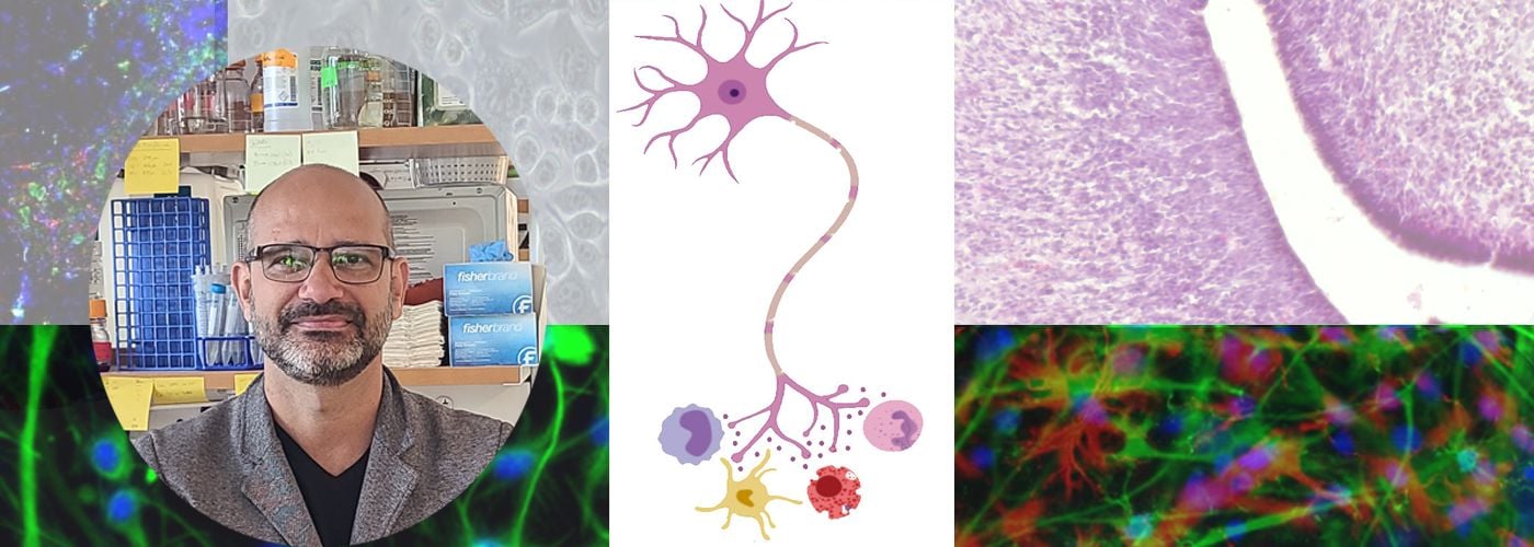 Neuroimmune interactions laboratory neuron images relative to study