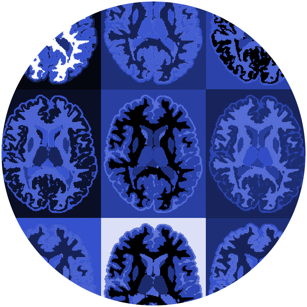 UMass Chan Department of Neuroimmunology and Multiple Sclerosis Center