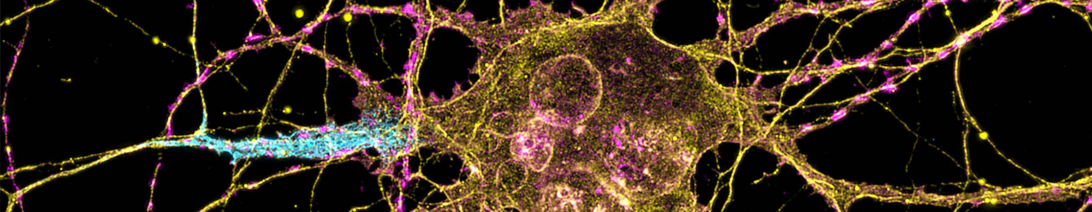 About us neuron for neurology.jpg