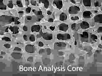 Cores-BoneAnalysis.png
