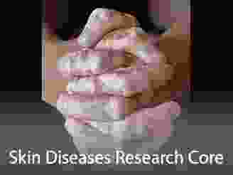 Cores-SkinDiseasesResearch.png