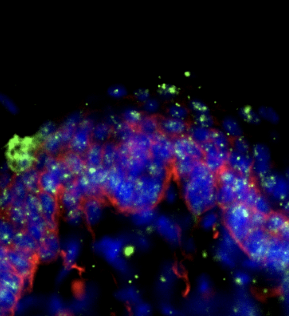 neurons innervating between skin cells shown in bright, fluorescent colors