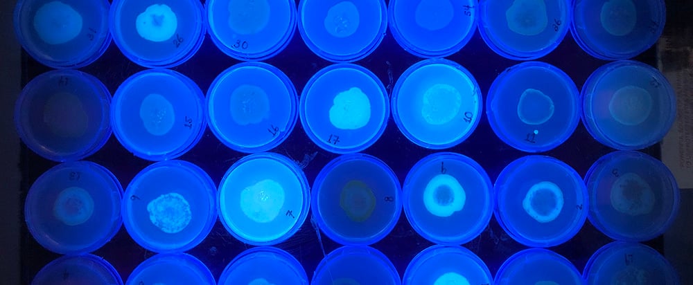 Bacterial Pathogenesis
