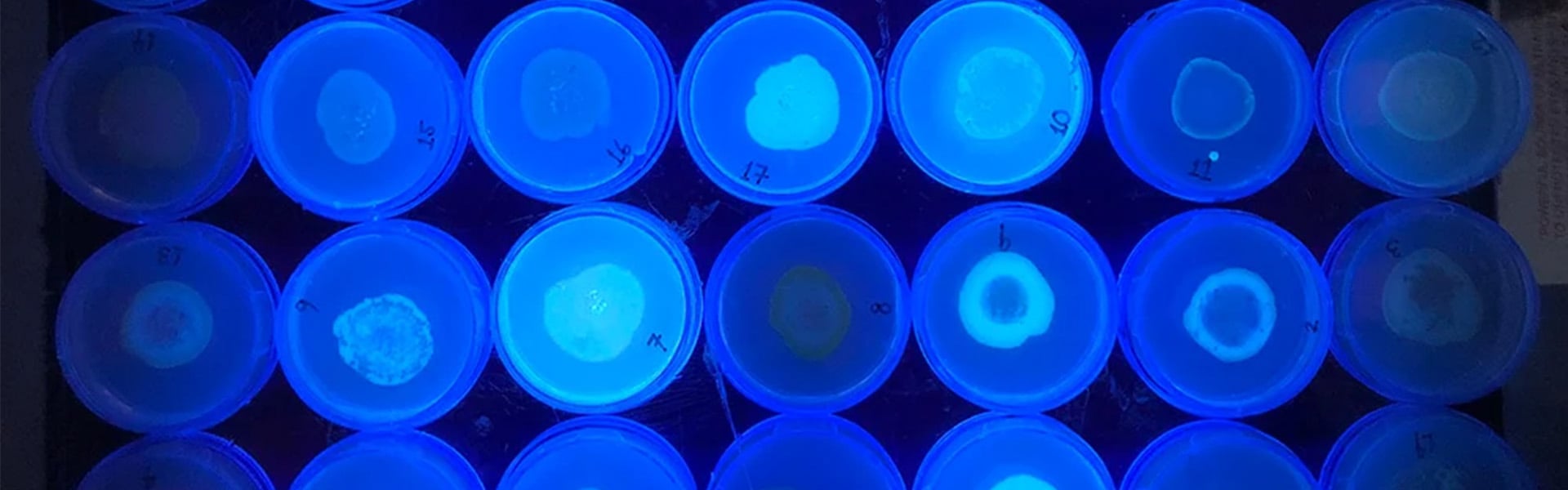 Pseudomonas aeruginosa