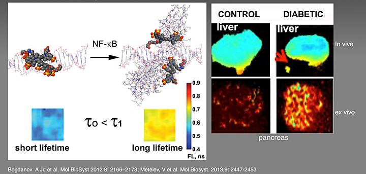 Molecular Fluorescence Lifetime Imaging Sensor of Pro-inflammatory Signaling in Diabetes