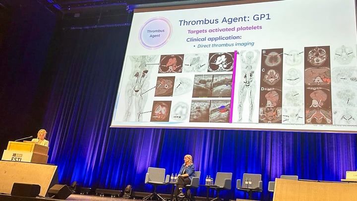 Lacey McIntosh at European Society of Thoracic Imaging