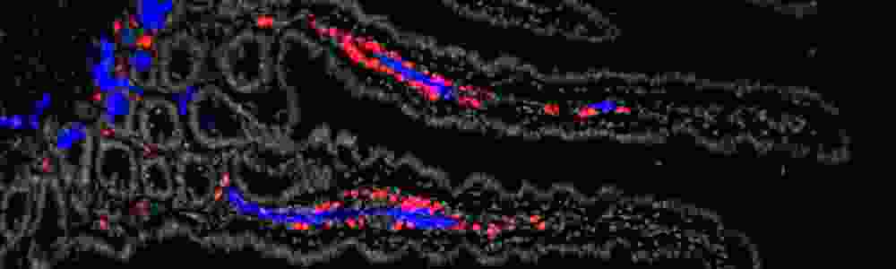 Immunofluorescence mouse intestinal villi