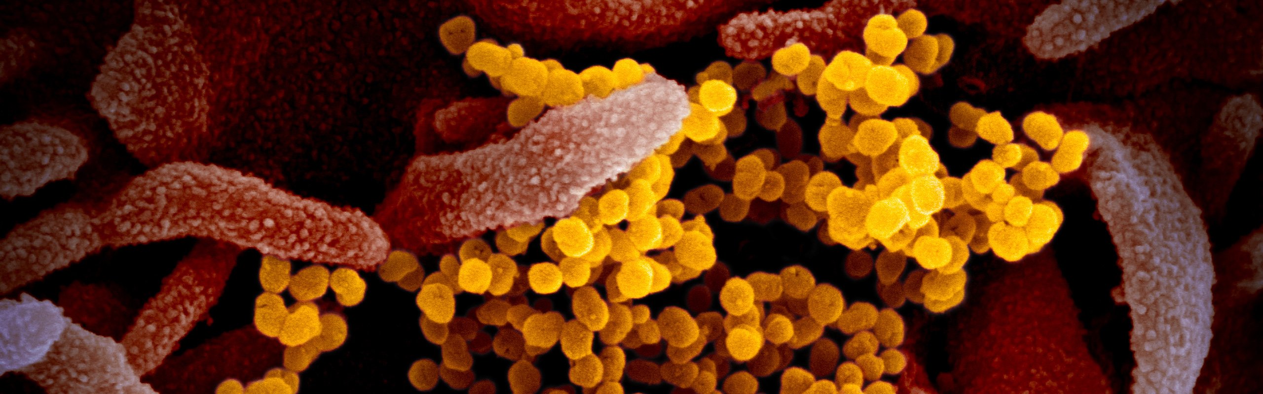 1600x500 slider SARS.jpg