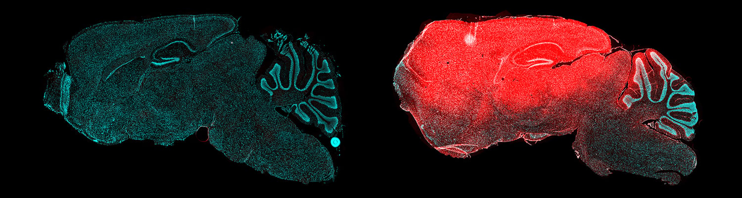 Brain tissue treated with siRNA