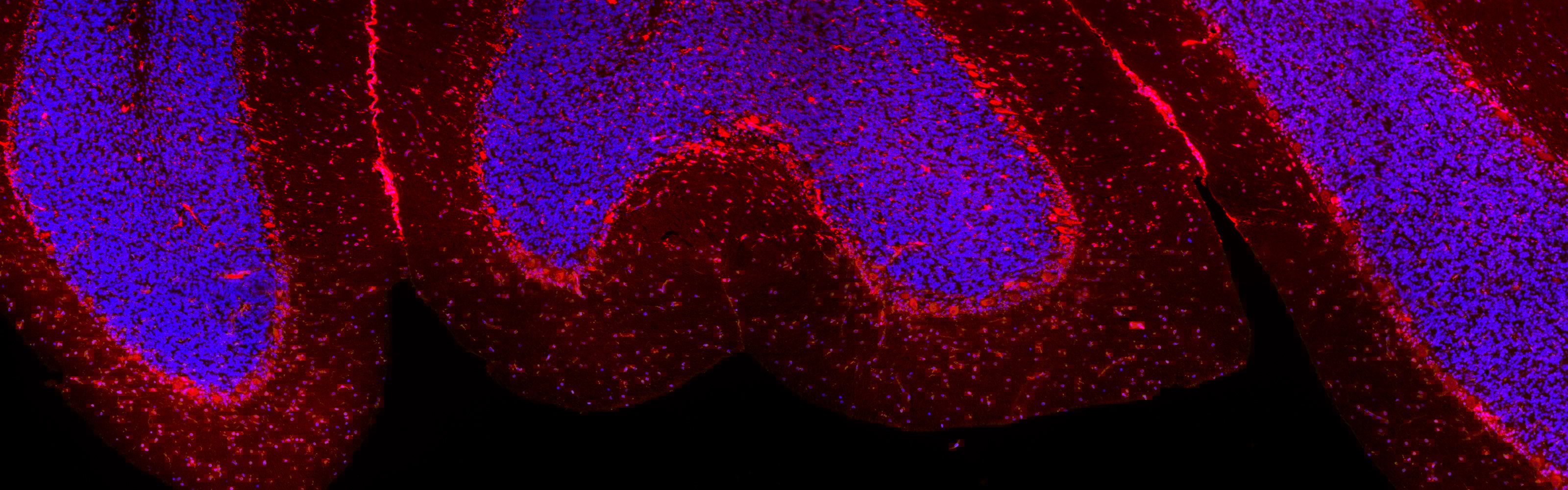 Chantal, Julia, Coverart tiles.lif - 5ezoom1_Merging_001 (RGB).jpg