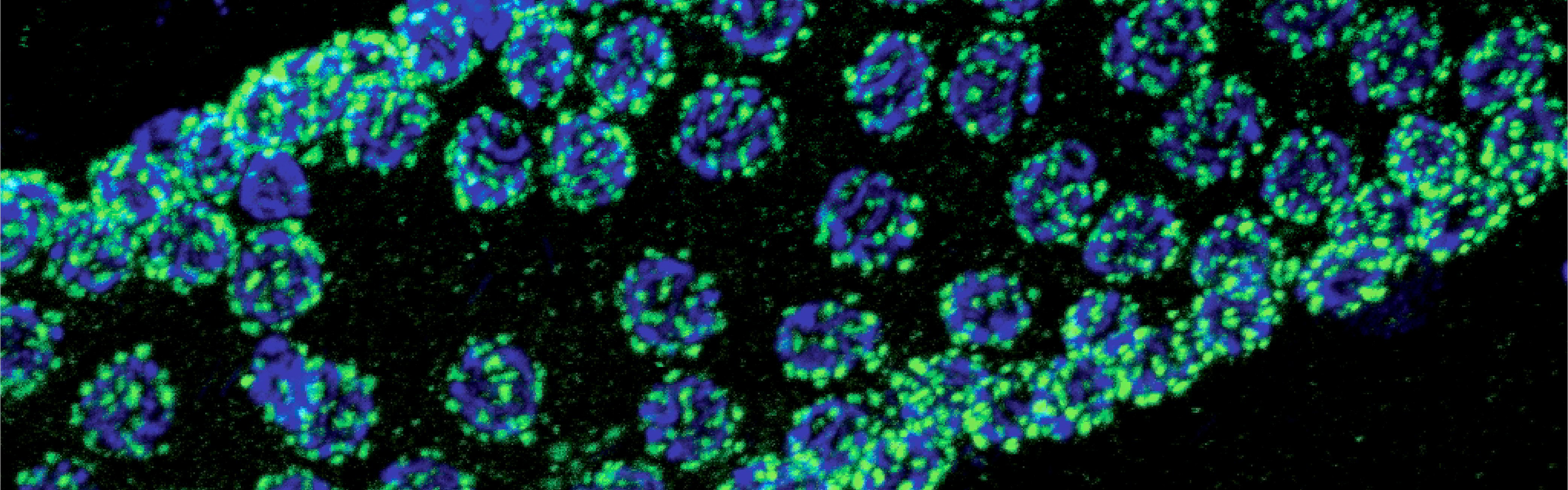 Rnai Screen Summary Rnai Screen Summary Or Download Scientific Diagram