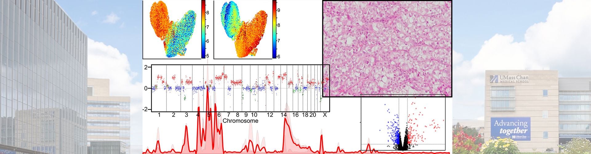 Sarcoma lab banner with umass campus photo in background