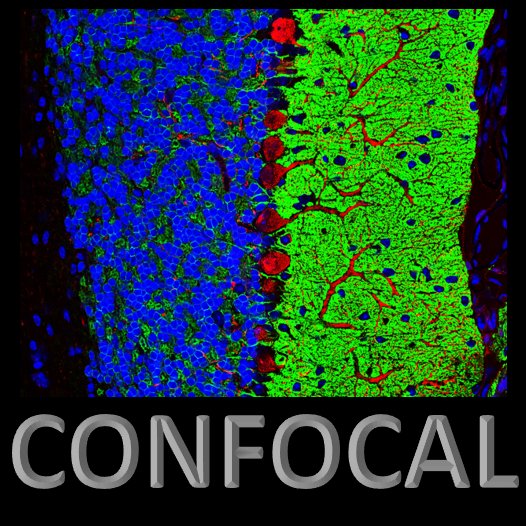 Confocal microscopy
